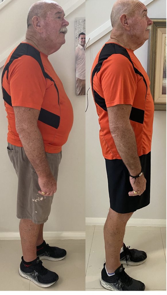 Effects of Being Overweight or Obese
